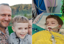 Лошата вест брзо се прошири: При вадење млечни заби, почина петгодишно момче, претходно 37 денови беше во кома