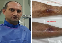 Чудата на доктор Сашко Николов: Неговиот последен зафат ги воодушеви сите (ФОТО)