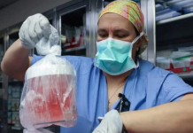 Прв пат во историјата на човек му е трансплантиран бубрег од свиња