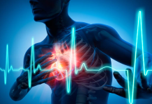 Два рани знаци кои може да укажуваат на срцев удар