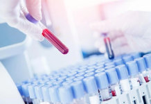 Пациентот личи на дух – Вирус сличен на ебола се заканува низ Европа, 300 луѓе се под надзор