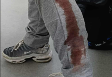 Татко од Велес шокиран: Во ваква ситуација го пронашол својот 10-годишен син: Бил нападнат од куче