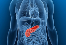 Не ги игнорирајте овие знаци: Лекарите предупредуваат на скриените симптоми на рак на панкреасот